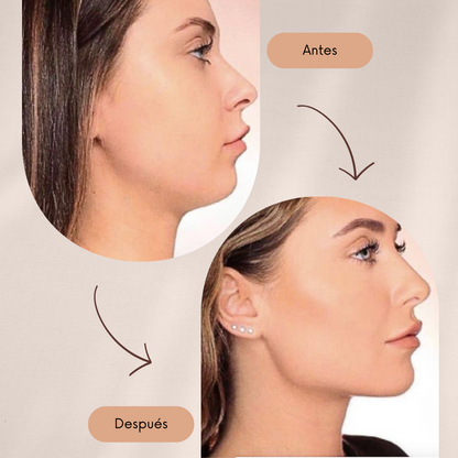 SkinLift - Tonifica tu rostro